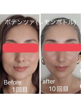 メルシー(merci)/ポテンツァ(レモンボトル)