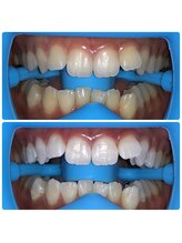 コナホワイトニング 神保町/セルフホワイトニング