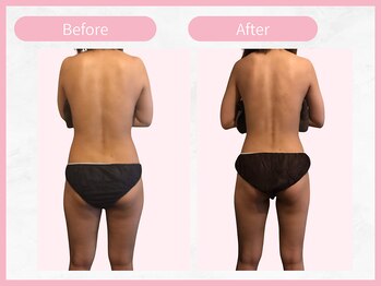 アールエイチビー 藤沢店(RHB)/