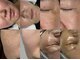 フェリス(FELIZ)の写真/悩む肌人生から卒業!肌が変わると表情まで変わる!今すぐお肌を変えたい方はまずオフ美容から◎