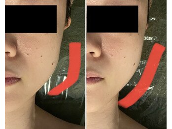 トリニティ 横浜店(TRINITY)/フェイスラインがシャープに！！