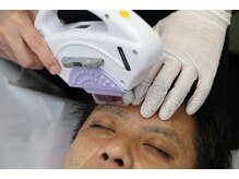 美容脱毛専門サロン エピラージュ 新宿店(Epilage)/アイブロウ前後に眉脱毛も可能