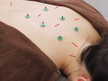 とまり木鍼灸整骨院 北青山院/身体の不調に