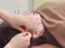 和燈の雰囲気(人気の美容鍼!身体から整えることで相乗効果UP!)