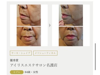 まりも化粧品店/ホワイトスノーピール