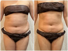 美容整体ウェリナ あま甚目寺院/小顔矯正/骨盤矯正/美脚サロン