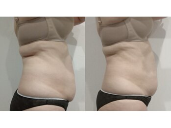 スキンスタジオ レア(Lea)/