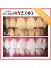 【☆大人気！春の限定価格☆】お試し40分照射¥8,980→¥2,000