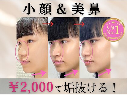 ラプリ 梅田店(Raplit)の写真