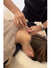 とも芦屋接骨院/鍼灸施術