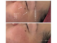 アイリーボーテ 東大阪(アイリーBEAUTE)