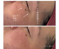 アイリーボーテ 東大阪(アイリーBEAUTE)