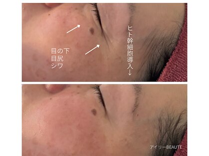 アイリーボーテ 東大阪(アイリーBEAUTE)の写真