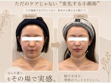 小顔フェイスラボ 姫路店(小顔 Face Labo.)の雰囲気（5回目からは無料で小顔矯正をプレゼント！骨格から小顔に改善♪）