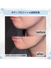 アクティブエイジング 大阪店/エンビロン/ボディプロファイル