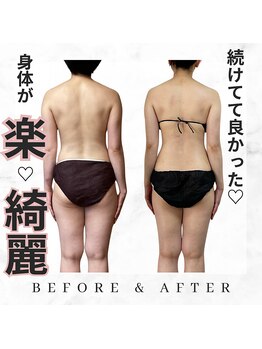 オルオル(.olu olu)/背中の結果写真(美骨&筋膜)