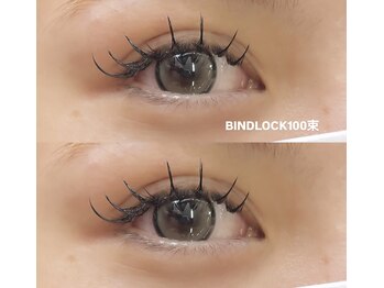 ビュー(V.I.E.W)/BINDLOCK100束