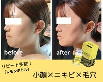 エステティックサロン さら