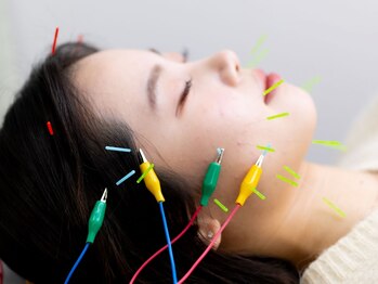 望鍼灸院【肩こり/腰痛/不眠/美容鍼】の写真/【当日予約OK】むくみ・たるみ・シワを内側から整える、痛みの少ない美容鍼