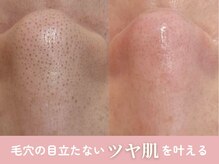ミュー 春日井店(mieux)
