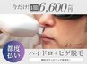 【夏のベタつき&ヒゲ撃退】ハイドロ小鼻毛穴洗浄＋ヒゲ脱毛（選べる2カ所）