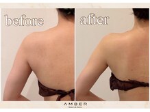 アンバー 恵比寿(AMBER)の雰囲気（【ブライダル】1ヶ月前駆け込み痩身◎まずは1度ご体感ください♪）