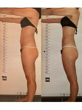 ビューティースパ/お尻・お腹ボリュームダウン