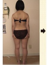 ノットノット 自由が丘(Not Knot)/１.ボディ スペシャル 施術前