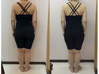 マーナ 谷山笹貫店(Ma-Na)/30代ダイエットビフォーアフター