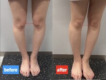 スフィーダ(SFIDA)/足の隙間改善！