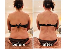 ラクア/筋膜リリース＆ボディケアコース