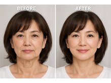 トータルエステティック ライム(lime)/顔たるみ改善!!自信ある私になる