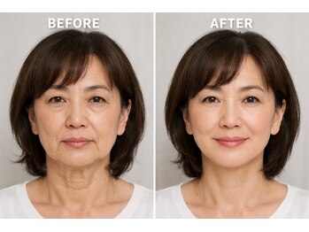 エステティック ライム(Esthetic Lime)/顔たるみ改善!!自信ある私になる