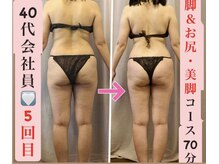 マール(Mar)の雰囲気（まっすぐ美脚・上がったお尻・華奢なボディへ！痩身/強圧リンパ）