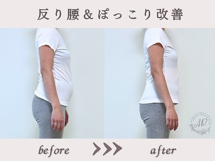 エーアール(AR)の写真