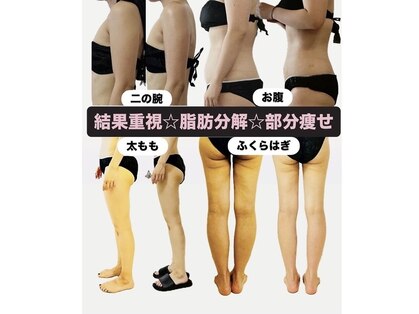 レアティ(Leathy)の写真