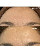 ベルアイラッシュ(Belleyelash)/【フェイシャルワックス】