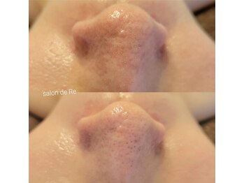 サロンドリー(salon de Re)/超音波エクストラクション