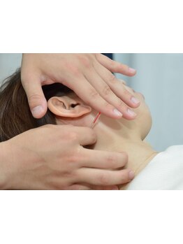 鍼灸施術を受けたい