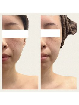 ヴィヴ コレビ(VIV COREBI)/一大イベントの前に最高☆