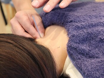 アイキュア鍼灸接骨院 中目黒(iCure鍼灸接骨院)/鍼灸