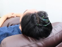 ユエ 日本橋店(YUE)/鍼＋パルスの施術の様子 