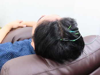 ユエ 日本橋店(YUE)/鍼＋パルスの施術の様子 