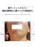 最新韓国瞬間小顔◇脂肪分解剤導入&脂肪分解キャビ（頬+顎下）&深層ラジオ波&