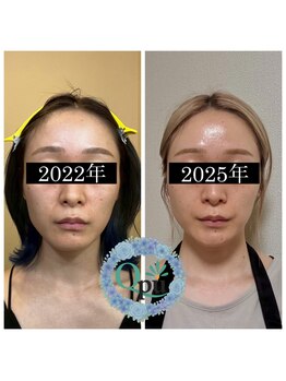 キュープ 群馬吉岡店(Qpu)/セルフケアのみ！！！