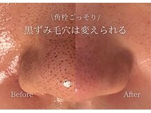 アトランティカ(ATLANTICA)の雰囲気（ATLANTICAはどんな肌のお悩みでも圧倒的な解決力！施術後即体感）