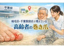巻き爪じゅん 千葉駅前店/高齢者の巻き爪は悪化しやすい？