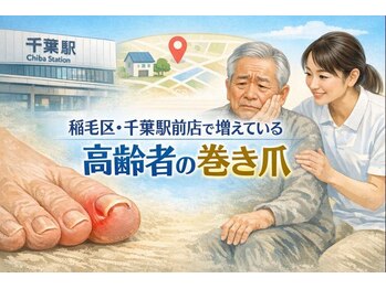 巻き爪じゅん 千葉駅前店/高齢者の巻き爪は悪化しやすい？