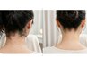 【脱毛】うなじ＋えりあし脱毛　30分　6000円