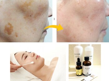 シェリー(CHERIE)/シミ くすみケア 透明感には